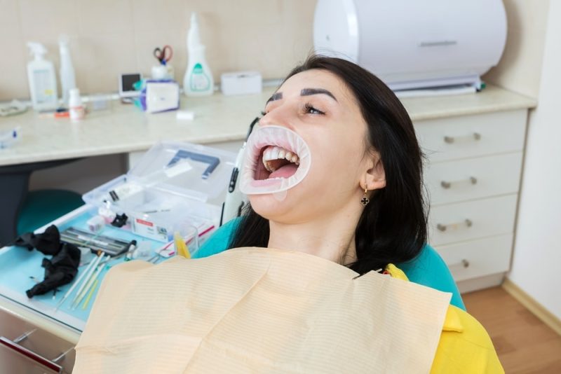 restorative dentist san antonio